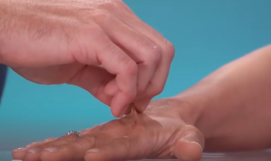 Hand Pinch Test